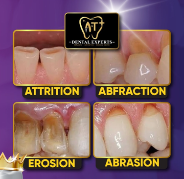 Slider image (8) Dr. A & T Dental Experts